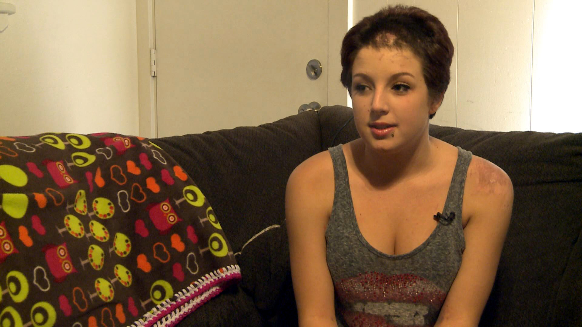 Teen speaks out after near death in Lake Pleasant accident