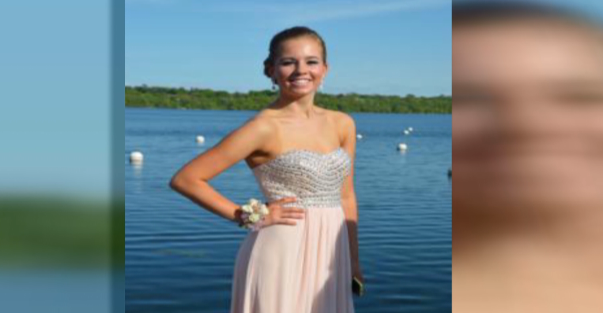 17yearold dies after wisdom teeth removed